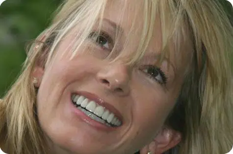 porcelain veneers by dr sam simos allstar implants plus