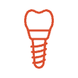 Here's an alt tag for the image: `Dental implant icon`
