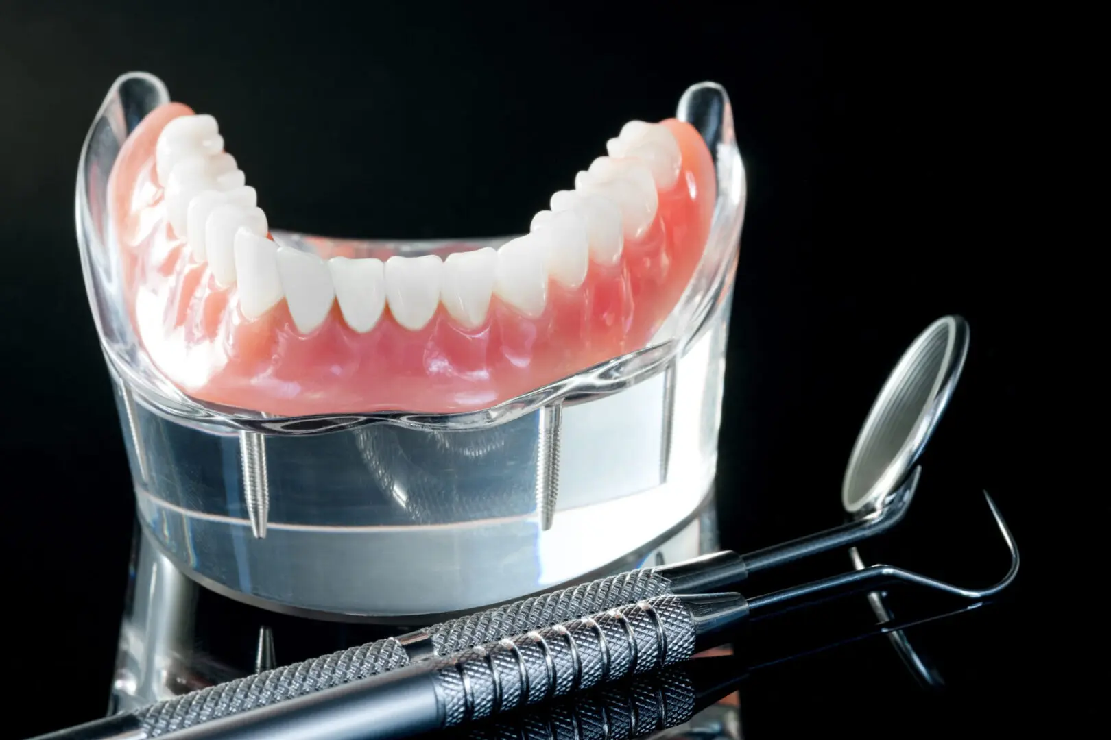 dental implants full arch of missing teeth