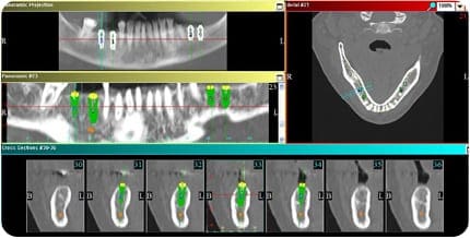 3D CBCT