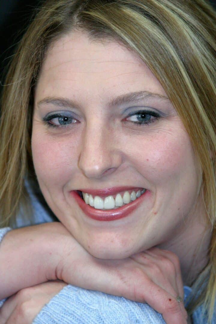 cosmetic porcelain veneers close gap by dr sam simos allstar implants plus