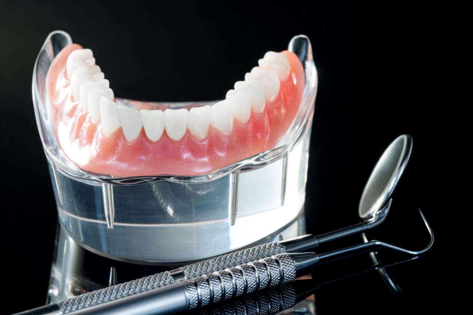 Allstar Implants Plus tooth implants for implant denture